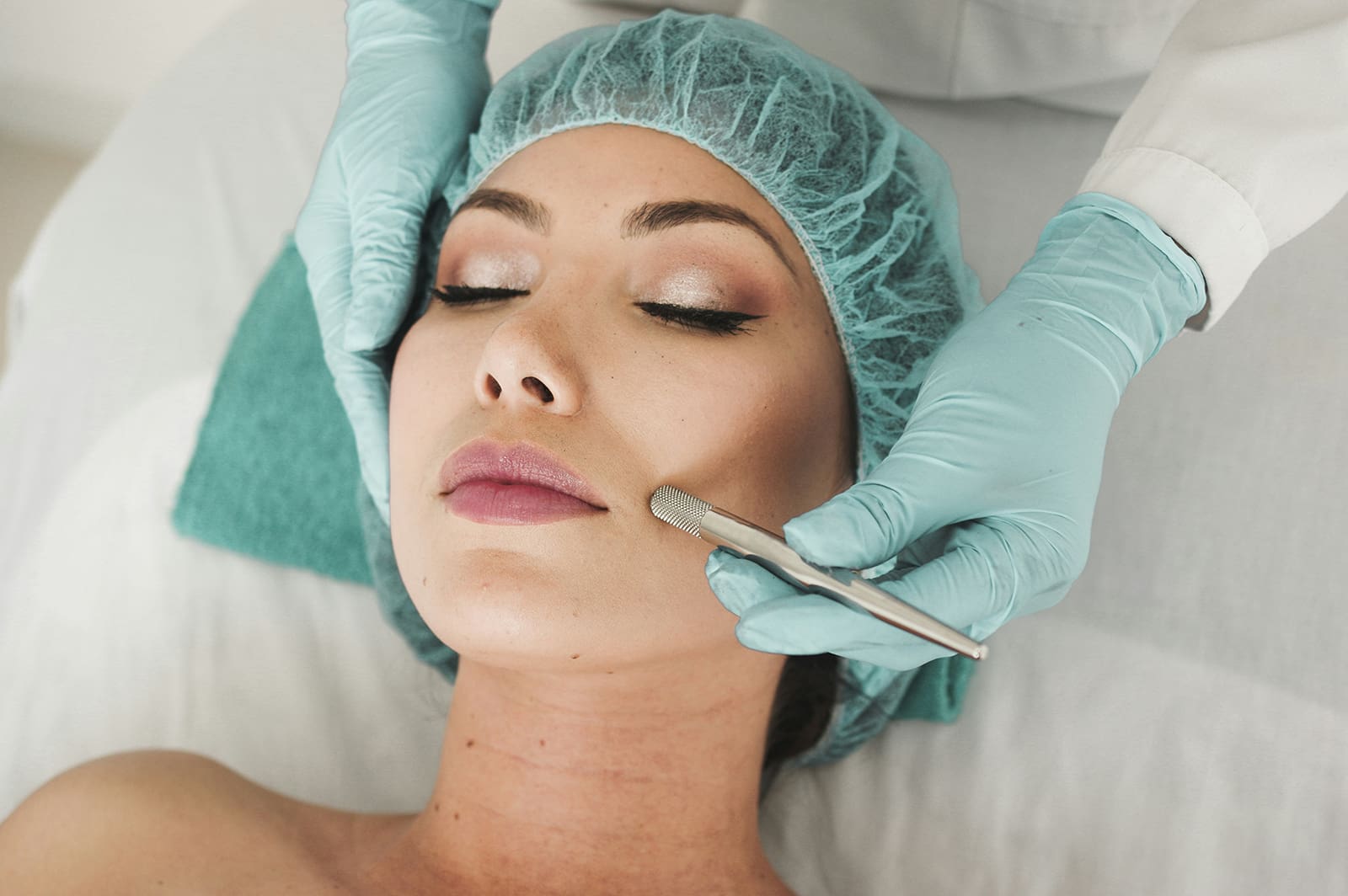 PMMA-procedimentos-esteticos